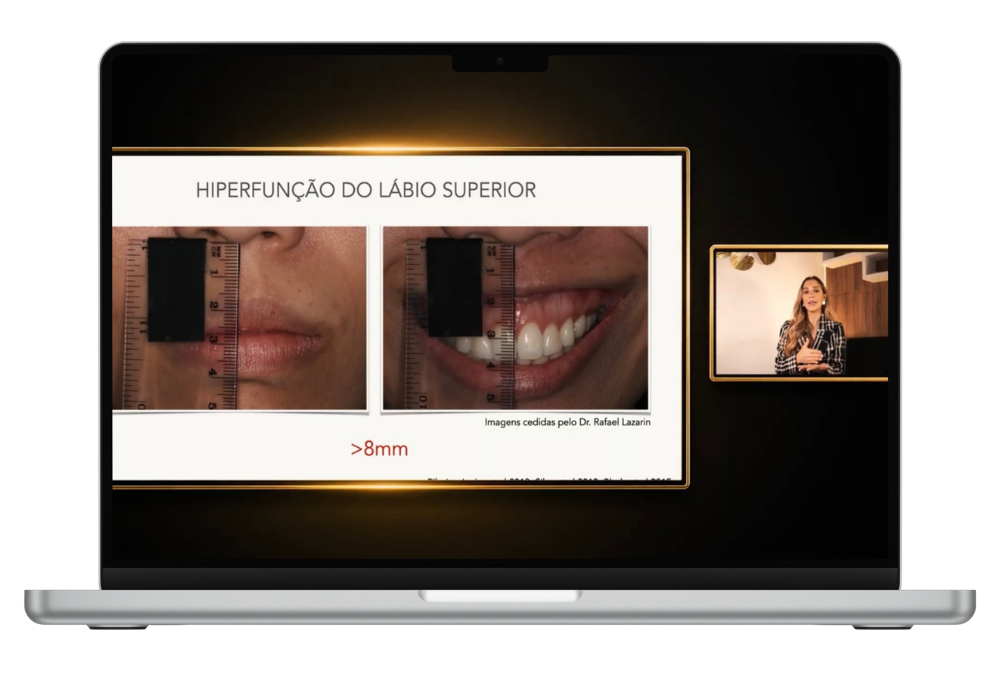Imagem de hiperfunção
