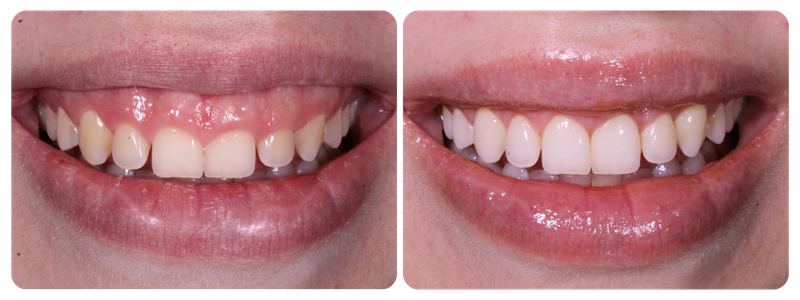 Imagem antes x depois 01